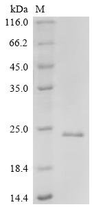 Drosophila melanogaster FMRFamide receptor (FMRFaR), partial Recombinant Protein, Drosophila melanogaster (Fruit fly), E.coli, N-terminal 6xHis-tagged, 20.5 kDa, purity >≥ 85% as determined by SDS-PAGE.