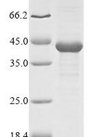 Carcinoscorpius rotundicauda Limulus clotting factor C, partial Recombinant Protein - BioCrest Sci