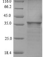 Aedes aegypti Long form salivary protein D7L1 (D7) Recombinant Protein, N-His, aa 18–321, E.coli - BioCrest Sci