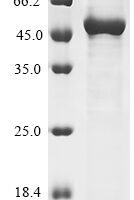 Mouse Lysosomal acid Glucosylceramidase (Gba1) Recombinant Protein, Tag-Free - BioCrest Sci