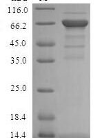 Human All-trans-retinol dehydrogenase [NAD (+)] ADH4 (ADH4) Recombinant Protein - BioCrest Sci