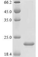 Mycobacterium bovis Immunogenic protein MPB70 (mpb70), Biotinylated Recombinant Protein - BioCrest Sci