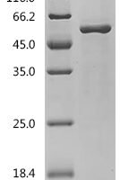 Mouse Angiopoietin-related protein 4 (Angptl4) Recombinant Protein, N-His - BioCrest Sci