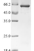 Xenopus laevis Peroxisome proliferator-activated receptor gamma (pparg) Recombinant Protein - BioCrest Sci