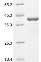 Human Cysteine-rich protein 1 (CRIP1) Recombinant Protein - BioCrest Sci
