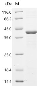 Human Cysteine-rich protein 1 (CRIP1) Recombinant Protein, Homo sapiens (Human), E.coli, C-terminal GST-tagged, 40.0 kDa, purity >≥ 85% as determined by SDS-PAGE.