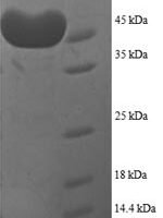 Human Proteasome subunit alpha type-7 (PSMA7), partial Recombinant Protein - BioCrest Sci