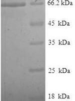 Human Tubulin beta-2A chain (TUBB2A) Recombinant Protein, N-His-SUMO - BioCrest Sci