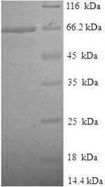 Human Tubulin beta-2A chain (TUBB2A) Recombinant Protein, N-His-SUMO, Homo sapiens (Human), E.coli, N-terminal 6xHis-SUMO-tagged, 65.9 kDa, purity >≥ 90% as determined by SDS-PAGE.