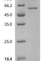 Human Cytochrome P450 11B2, mitochondrial (CYP11B2) Recombinant Protein, N-His, aa 25–503, E.coli - BioCrest Sci