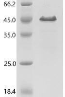 Human Clathrin light chain A (CLTA) Recombinant Protein, C-His - BioCrest Sci