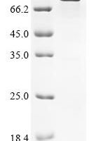 Human Ubiquitin thioesterase ZRANB1 (ZRANB1) Recombinant Protein - BioCrest Sci