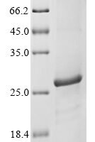 Plasmodium falciparum Reticulocyte binding protein 2 homolog b (Rh2b), partial Recombinant Protein - BioCrest Sci