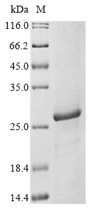 Plasmodium falciparum Reticulocyte binding protein 2 homolog b (Rh2b), partial Recombinant Protein, Plasmodium falciparum (isolate 3D7), E.coli, Tag-Free, 23.3 kDa, purity >≥ 85% as determined by SDS-PAGE.
