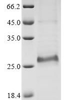 Bovine coronavirus Protein I (N) Recombinant Protein, C-His, aa 1–207, strain 98TXSF-110-ENT - BioCrest Sci