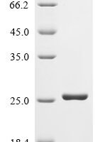 Escherichia coli LPS-assembly lipoprotein lptE (lptE) Recombinant Protein - BioCrest Sci