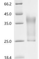 Human Rap1 GTPase-activating protein 1 (RAP1GAP), partial Recombinant Protein - BioCrest Sci