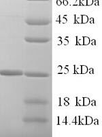 Human Kallikrein-7 (KLK7), partial Recombinant Protein, N-His - BioCrest Sci