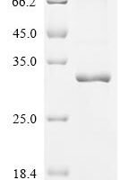 Human Ras-related and estrogen-regulated growth inhibitor-like protein (RERGL) Recombinant Protein - BioCrest Sci