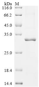 Human Ras-related and estrogen-regulated growth inhibitor-like protein (RERGL) Recombinant Protein, Homo sapiens (Human), E.coli, N-terminal 10xHis-tagged and C-terminal Myc-tagged, 28.9 kDa, purity >≥ 85% as determined by SDS-PAGE.