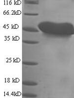 Mouse Mesothelin (Msln), partial Recombinant Protein, N-His - BioCrest Sci