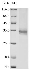 Bovine coronavirus Non-structural protein 2a (2a) Recombinant Protein, C-His, aa 1–278, strain LY-138, Bovine coronavirus (strain LY-138) (BCoV) (BCV), Baculovirus, C-terminal 6xHis-tagged, 37.7 kDa, purity >≥ 90% as determined by SDS-PAGE.