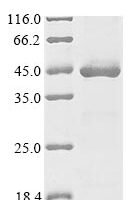 Rhizobium meliloti Probable sulfoacetaldehyde acetyltransferase (xsc), partial Recombinant Protein - BioCrest Sci
