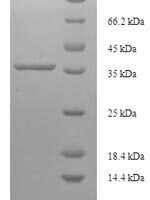 Human PDZ and LIM domain protein 3 (PDLIM3) Recombinant Protein - BioCrest Sci