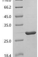 Human Lipocalin-1 (LCN1) Recombinant Protein, C-His, aa 19–176, E.coli - BioCrest Sci
