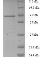 Staphylococcus aureus Enterotoxin type C-1 (entC1) Recombinant Protein - BioCrest Sci