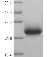 Mouse von Willebrand factor (Vwf), partial Recombinant Protein, N-His/C-Myc - BioCrest Sci