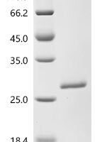 Human Ribosomal protein eL39-like 2  (RPL39L) Recombinant Protein - BioCrest Sci