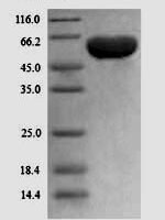 Human Peroxisome prolifeRator-activated receptor gamma (PPARG) Recombinant Protein - BioCrest Sci