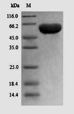 Human Peroxisome prolifeRator-activated receptor gamma (PPARG) Recombinant Protein, Homo sapiens (Human), Yeast, N-terminal 6xHis-tagged, 56.3 kDa, purity >≥ 90% as determined by SDS-PAGE.