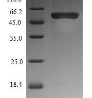 Xenopus laevis Protein Wnt-8 (wnt8) Recombinant Protein, N-His-B2M - BioCrest Sci