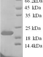Rat Ephrin-A1 (Efna1) Recombinant Protein, N-His, aa 18–182, Yeast - BioCrest Sci