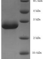 Macaca fascicularis Erythropoietin (EPO) Recombinant Protein - BioCrest Sci