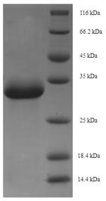 Macaca fascicularis Erythropoietin (EPO) Recombinant Protein, Macaca fascicularis (Crab-eating macaque) (Cynomolgus monkey), E.coli, N-terminal 6xHis-SUMO-tagged, 34.2 kDa, purity >≥ 90% as determined by SDS-PAGE.