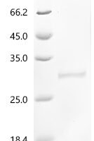 Human cytomegalovirus Enhanced green fluorescent protein (egfp) (V164A,S176G) Recombinant Protein - BioCrest Sci