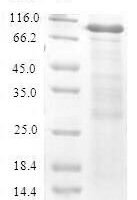 Mouse Cystathionine beta-synthase (Cbs) Recombinant Protein, N-His-SUMO - BioCrest Sci