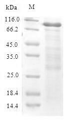 Mouse Cystathionine beta-synthase (Cbs) Recombinant Protein, N-His-SUMO, Mus musculus (Mouse), E.coli, N-terminal 6xHis-SUMO-tagged, 77.4 kDa, purity >≥ 90% as determined by SDS-PAGE.