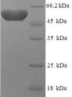 Human Protein atonal homolog 1 (ATOH1) Recombinant Protein, N-His-SUMO - BioCrest Sci