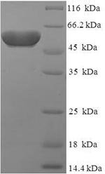 Human Protein atonal homolog 1 (ATOH1) Recombinant Protein, N-His-SUMO, Homo sapiens (Human), E.coli, N-terminal 6xHis-SUMO-tagged, 54.2 kDa, purity >≥ 90% as determined by SDS-PAGE.