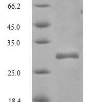 Mouse CD82 antigen (Cd82), partial Recombinant Protein - BioCrest Sci