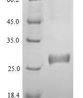 Human DNA (cytosine-5)-methyltransferase 3A (DNMT3A), partial Recombinant Protein - BioCrest Sci