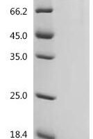 Glycine max non-specific serine/threonine protein kinase (100817960), partial Recombinant Protein - BioCrest Sci