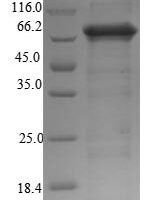Rat Neuroendocrine convertase 2 (Pcsk2) Recombinant Protein - BioCrest Sci