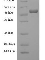 Mouse Complement C3 (C3), partial Recombinant Protein - BioCrest Sci