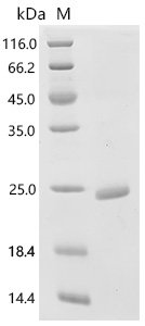 Human Bone morphogenetic protein 15 (BMP15) Recombinant Protein, E.coli, C-terminal 6xHis-tagged, 20.9 kDa, purity >≥ 90% as determined by SDS-PAGE.