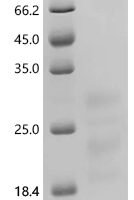 Human Interferon gamma (IFNG), Biotinylated Recombinant Protein - BioCrest Sci